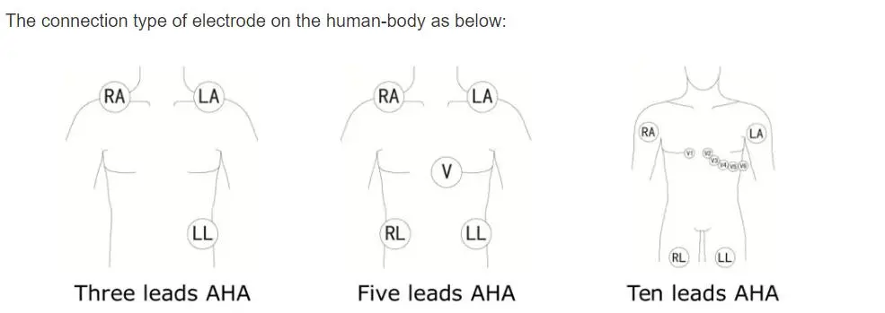 5-adrige EKG-Ableitungen für Philips Digitrak plus 24-Stunden-Holter 3100A, 5-adrig, Snap